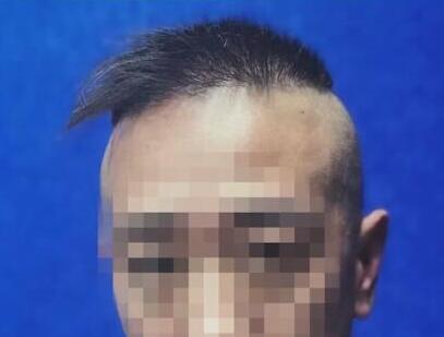 奇特發型偷車賊被一眼鎖定 民警：想不記住都難
