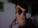 廣東一殘疾男子遭妻子家暴被打傷下體，半年前曾獲人身保護令