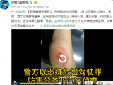 阜陽一男子醉駕肇事洋相百出 哭鬧撒潑咬傷民警