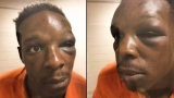 美國(guó)警方暴力執(zhí)法事件再次發(fā)生 非裔男子被毆打致昏迷 